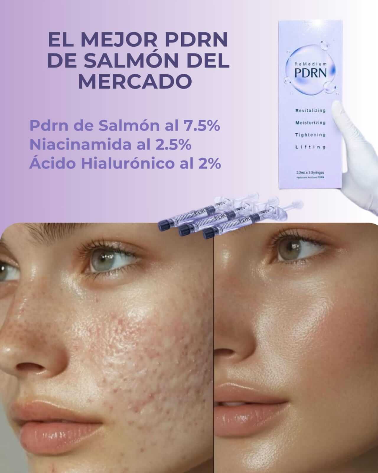 Antes y después 5